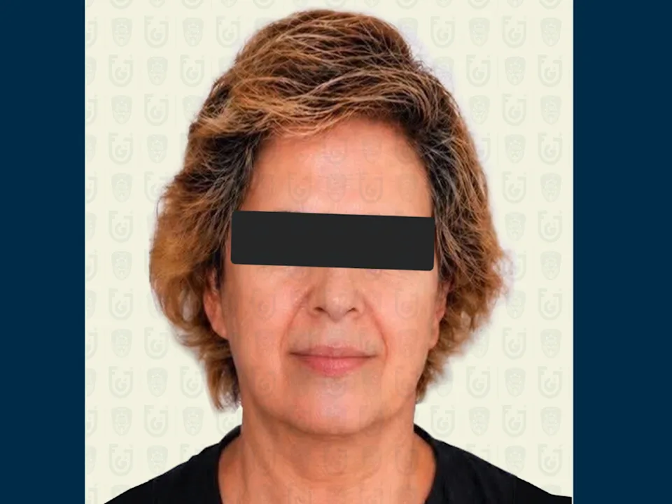 Erika «N», suegra de exreina de belleza Carolina Flores, dice que la mató por «accidente»